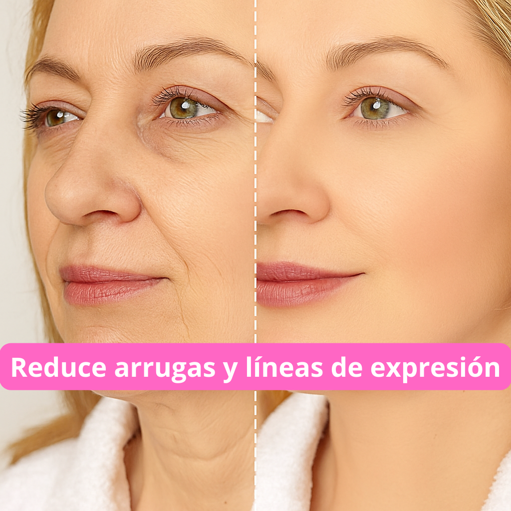 ✨Masajeador Facial LED * Reafirma y Reduce líneas de expresión * Piel más joven✨