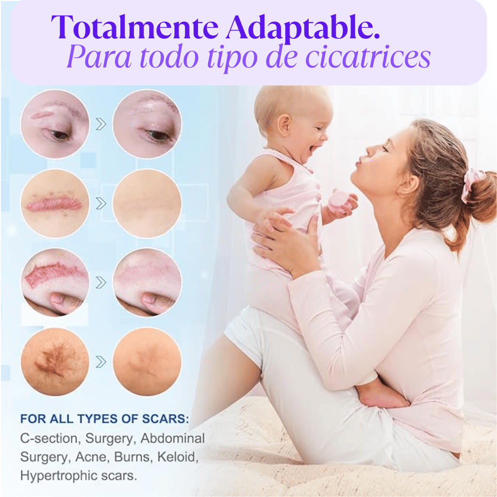 💫 Cinta Gel de Silicona 💫 Suaviza y Alisa la Apariencia de Cicatrices y Líneas de Expresión