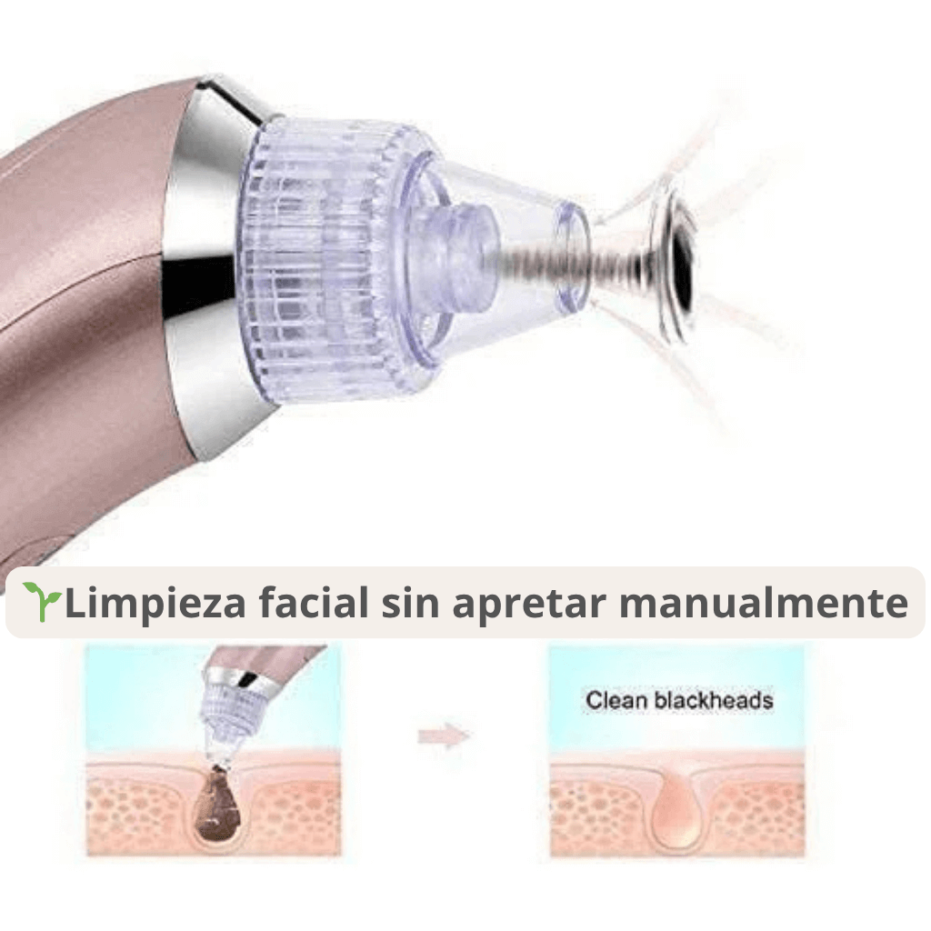 Extractor de Puntos Negros y Espinillas✨Ilumina tu Rostro✨
